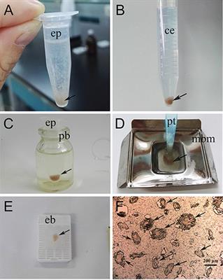 Serodiagnostic Potential of Alpha-Enolase From Sarcoptes scabiei and Its Possible Role in Host-Mite Interactions